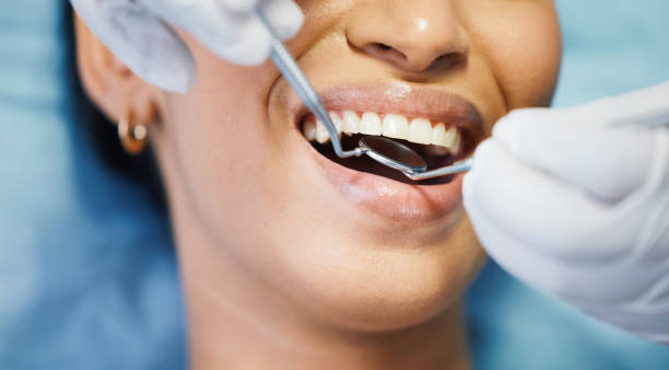 Best Emergency Dentist for Lost Fillings or Crowns in Briarcliff, TX