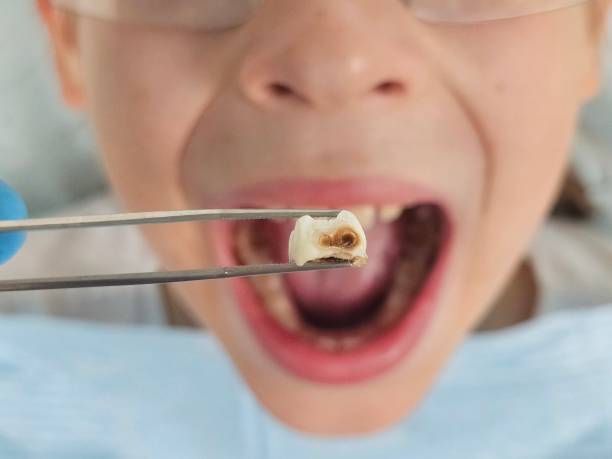 Best Urgent Dental Care for Toothache in Briarcliff, TX