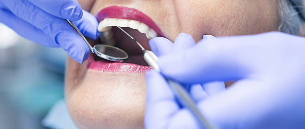 Best Emergency Root Canal Treatment in Briarcliff, TX